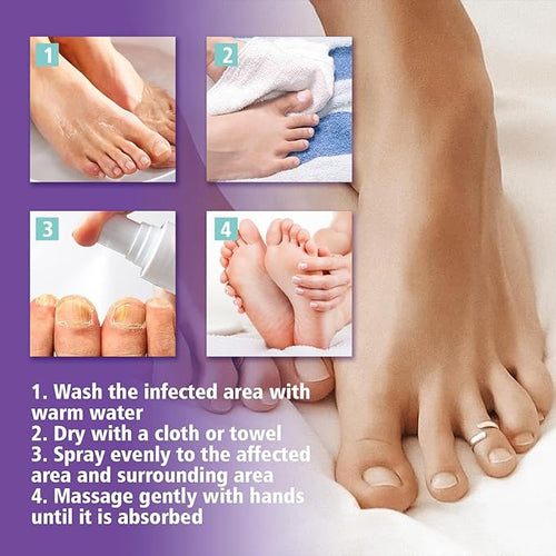 Gentle Nail Fungus Treatment Remover - Emirex UAE