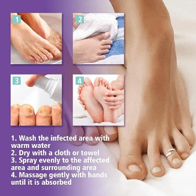 Nail Fungus Treatment Spray bottle - Emirex UAE